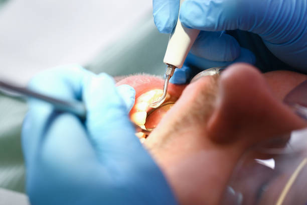 Best Root Canal Emergency Dentist  in Gridley, IL