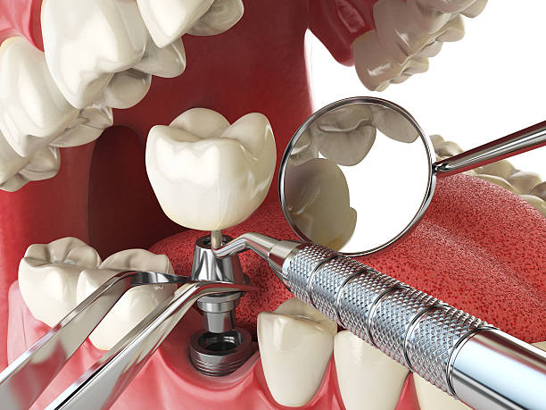 Best Urgent Tooth Repair  in Gridley, IL